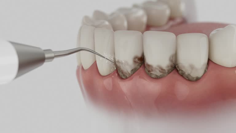 Trusted Wisdom Tooth Removal service in Exeter, CA - Dentist Open Now